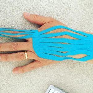 Kinesio Taping | Kinesiology | Sports Therapy | The Flying Physios
